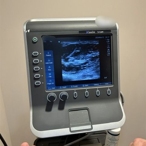 Sonosite S-Cath Ultrasound System